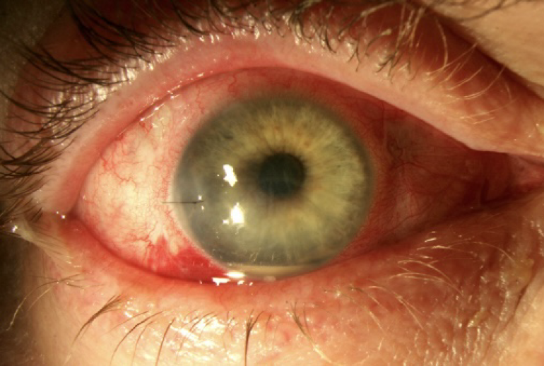 1732114152.098706_953856_image