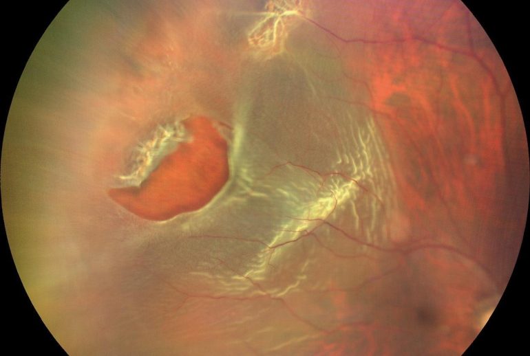 1732114163.437559_112403_image