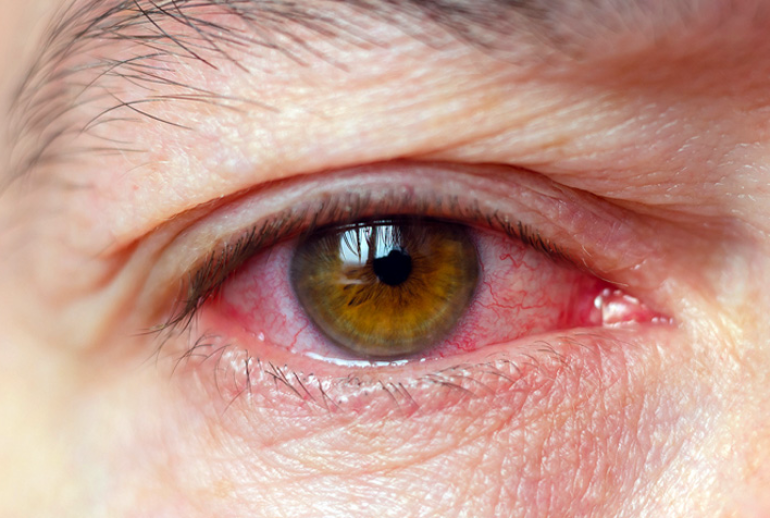 1732114176.098423_112324_image